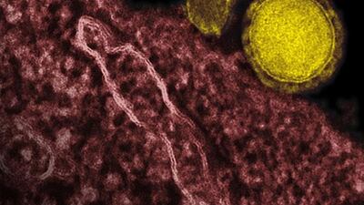 The deadly Mers coronavirus has killed at least 58 people so far. AP Photo / NIAID - RML