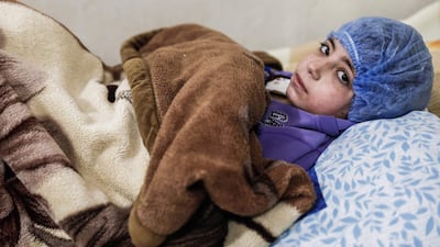Dania, 14, receives dialysis inside a basement-turned-clinic in the rebel-held town of Douma, on the outskirts of the capital Damascus, on March 16, 2017. Sameer Al Doumy / AFP
