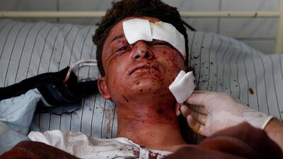 An Afghan man receives treatment at a hospital after a suicide attack in Kabul, Afghanistan March 21, 2018. Omar Sobhani / Reuters