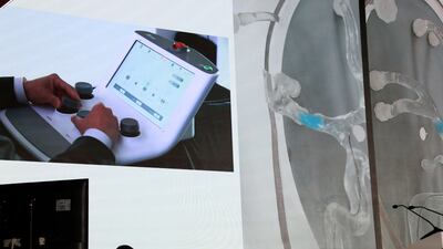 A doctor operating remotely from Abu Dhabi on a patient in South Korea. Wajod Alkhamis / The National