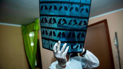 A doctor checks an X-ray of a Covid-19 patient in a house on the eastern outskirts of Lima. AFP