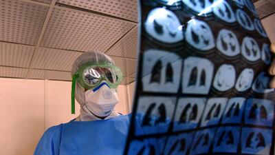 An Iraqi doctor wearing protective gear inspects a chest x-ray at Baghdad Medical City. EPA
