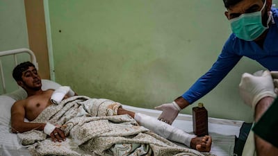 A wounded man receives treatment at a hospital in the northeastern Syrian Kurdish city of Qamishli, following a Turkish air strike that hit a convoy of vehicles carrying civilians and journalists. AFP