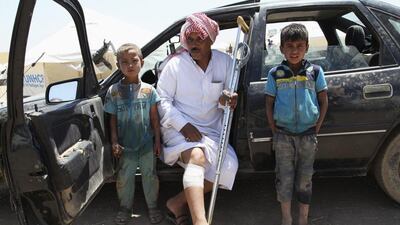 A wounded man, who fled violence in Mosul, sits in a camp on the outskirts of Erbil in Iraq's Kurdistan region on June 16, 2014. The Islamic State of Iraq and the Levant (ISIL) has taken captured several towns and cities in northern Iraq and is making its way towards Baghdad. Azad Lashkari/Reuters