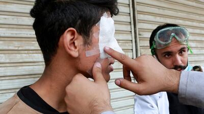 Iraqi protesters help their fellow protestor, who was wounded during clashes with riot police, following a protest at Al Rasheed street in central Baghdad. EPA