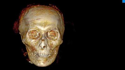A 3D reconstruction of the head of Amenhotep I created using computed tomography scans. By 'digitally unwrapping' the mummy, scientists for the first time since it was discovered in 1881 revealed its secrets without disturbing the funerary mask. AFP