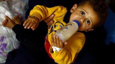 A Palestinian child suffering from malnutrition receives treatment at Al Awda health centre amid widespread hunger. Reuters
