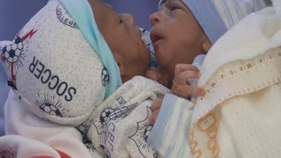 Conjoined Yemeni twins Muhammed, right, and Ahmed in an ambulance at Sanaa airport before a Unicef-chartered plane flew them to Jordan for surgical separation on February 6, 2021. EPA