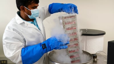 The stem cells are frozen with liquefied nitrogen and preserved at a temperature of -196°C for a period of up to 25 years. AP