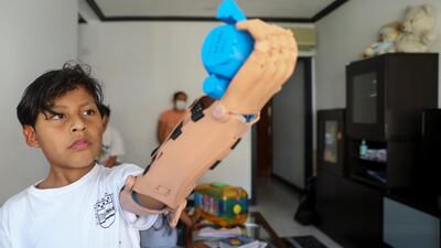 Juan Moyolema, an 8-year-old boy who was born missing the lower part of his left arm, raises a toy with a 3D printed tailor-made prosthetic given to him by Ayudame3D at his home in Parla, near Madrid, Spain. Reuters