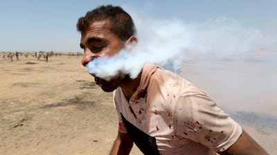 A wounded Palestinian demonstrator, Haitham Abu Sabla, 23, is hit in the face with a tear gas canister fired by Israeli troops during a protest marking al-Quds Day, (Jerusalem Day), at the Israel-Gaza border in the southern Gaza Strip June 8, 2018. Ibraheem Abu Mustafa / Reuters