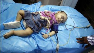 Naseeb, a seven-month baby, lies in a hospital in Tripoli. Qaddafi's aides brought foreign media to see her and described her as a wounded victim of a Nato air strike. But a hospital staff member, in a note passed to a journalist, said the infant was in fact injured in a car accident. Ahmed Jadallah / Reuters