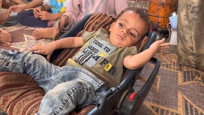 Abdul Rahman Abu Al Jidyan contracted polio in the first case in Gaza and the occupied territories for 25 years. Photo: Mohamed Elsaifi