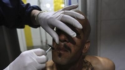 A drug addict is shaved after taking a cold shower as part of his treatment. Omar Sobhani / Reuters