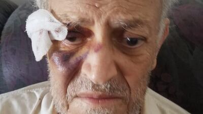 Hadi Succar, 76, was wounded in the blast and later died of a heart attack.