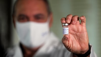 Director of the Finlay Vaccine Institute Vicente Verez shows a vial of Cuban vaccine Soberana 02, in Havana. Cuba has administered 5.11 million doses of its own vaccines. EPA-EFE