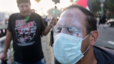 A protestor uses milk after being teargassed near the metropolitan detention center of downtown Los Angeles. AP