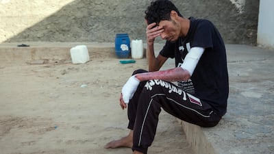 Hafedh Haddaji, 33, suffered severe burns while trying to save his wife after she set herself alight on June 21, 2017 in Maksouma, Tunisia. Dorsaf Haddaji died the same day at the age of 20. Sebastian Castelier for The National