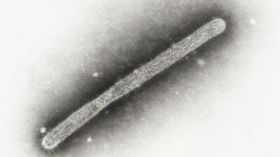 This 2005 electron microscope image shows an avian influenza A H5N1 virion. CDC via AP