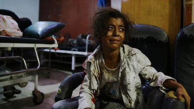 A handout image provided by the World Press Photo (WPP) organisation on 18 February 2016 shows a picture by photographer Abd Doumany that won Second Prize Stories in the General News Category of the 59th annual World Press Photo Contest, it was announced by the WPP Foundation in Amsterdam, The Netherlands on 18 February 2016. The picture shows a wounded Syrian girl crying at a makeshift hospital in the rebel-held area of Douma, east of the capital Damascus, following reported air strikes by regime forces, 12 August 2015. At least 27 civilians were killed in Syrian government air strikes on the Eastern Ghouta region near Damascus according to a monitoring group. Abd Doumany / EPA