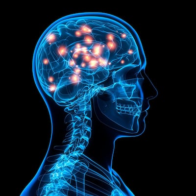 The number of people with Alzheimer's or dementia could reach 153 million by 2050. Getty Images