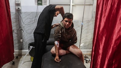 A Palestinian youth wounded in an Israeli attack on Al Bureij camp is treated at Al Awda Hospital, in Gaza City. Getty Images