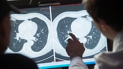 The research found that AI invented a diagnosis almost 20 per cent of the time when information was missing. Photo: AFP