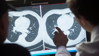 The research found that AI invented a diagnosis almost 20 per cent of the time when information was missing. Photo: AFP