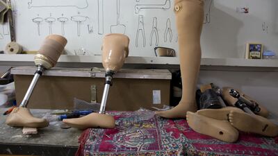 Prosthetics are seen on a table at the Artificial Limbs and Polio Center in Gaza City, Gaza , December11,2014. Many of the Palestinian’s wounded in last summer’s war between Israel and the Hamas-controlled Gaza Strip lost limbs. Heidi Levine for The National