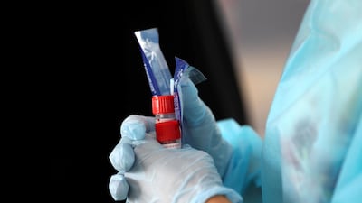 The twins had 10-hour shifts and will be reducing their volunteering hours to seven to eight hours, as they resume their university studies