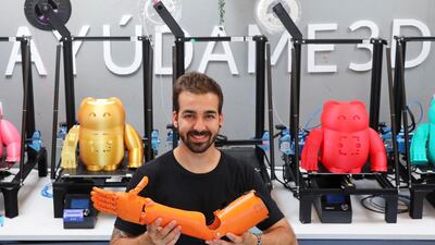 Guillermo Martinez holds a 3D printed prosthetic arm at his headquarters in Madrid. Reuters