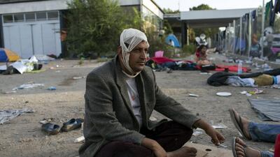 A migrant who was injured during clashes stands at the border with Hungary near the village of Horgos, Serbia. Marko Djurica / Reuters