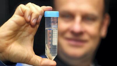 Hamish Harding with the new shrimp-like species he discovered at the bottom of the ocean. Chris Whiteoak / The National