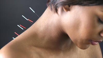 Dry needling uses the same needles as acupuncture, but is a completely different treatment. Getty Images