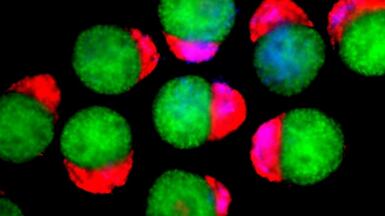 The team observed the emergence of the three-dimensional hematoids under a microscope in the lab. Jitesh Neupane / University of Cambridge