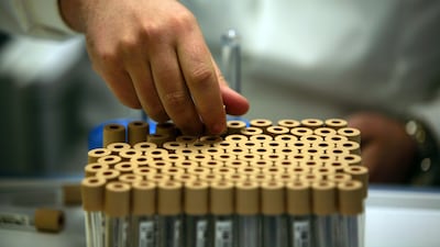 Blood from umbilical cords can play a key role in helping to save lives. Getty Images