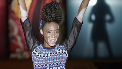 Winnie Harlow has the skin condition vitiligo. Carlos Alvarez / Getty Images