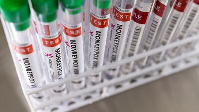 Monkeypox comes from the same family of viruses as smallpox. Reuters