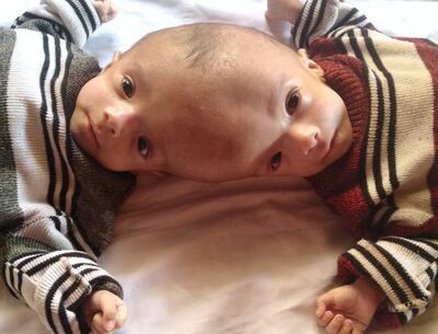 Twins Yaseen and Yousef at home in the village of Al Trais in Yemen. Ali Mahmood for The National