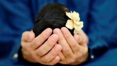 This baby was photographed at 14 days old. Courtesy Ana Severance