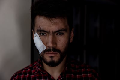 Nehmatullah Naqdi, 28, a video journalist with the EtilaatRoz newspaper, was also severely beaten by the Taliban.