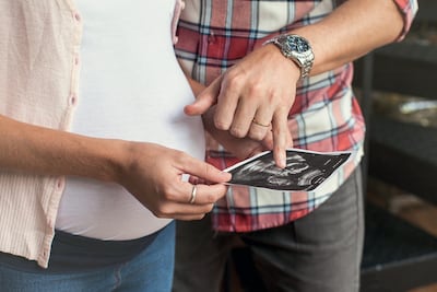 The model, which cannot develop into a foetus, could be used to study early development and develop new treatments to prevent miscarriage and genetic disorders. Getty