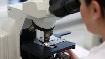 Excess weight almost doubles a woman’s risk of developing womb cancer, new research suggests. PA