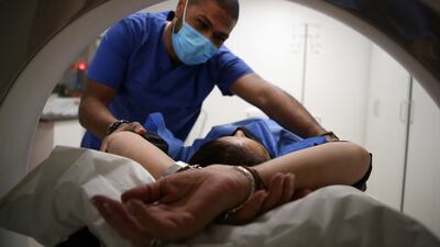 Most lung cancer cases are detected at later stages but those behind the new study want to reverse this. AFP