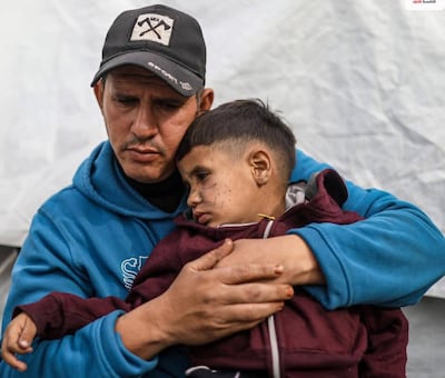 Adam, five, with his father, Mohammad Abu Halib, who says his son has received a medical referral for treatment abroad