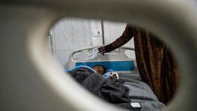 A boy lies on a hospital bed in Hasakeh after suffering burns when a fire broke out at a wedding party at Al Hol displacement camp in north-eastern Syria. AFP