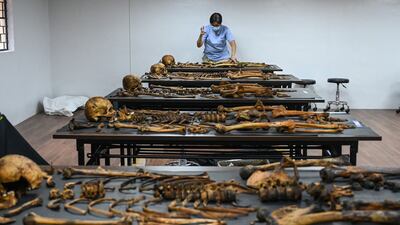 Forensic pathologist Raquel Fortun arranges the skeletal remains of a drugs war victim for autopsy in her laboratory in Manila. AFP