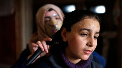 Izdihar Al Amawi combs her daughter's hair at their home in Gaza City on February 28, 2021. AFP