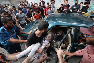 A child is injured in an Israeli air strike on Rafah, Gaza. AFP