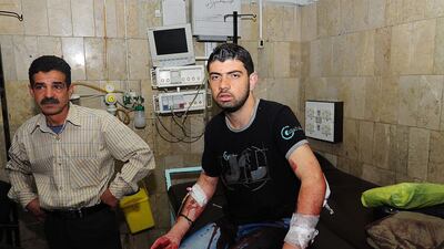 An injured Syrian man receiving first aid at a hospital in Damascus on April 13. According to SANA, two mortar shells landed in Damascus' Beirut Street and hit a bus, which allegedly led to the death of a girl and the injuring of 22 people. EPA/SANA
